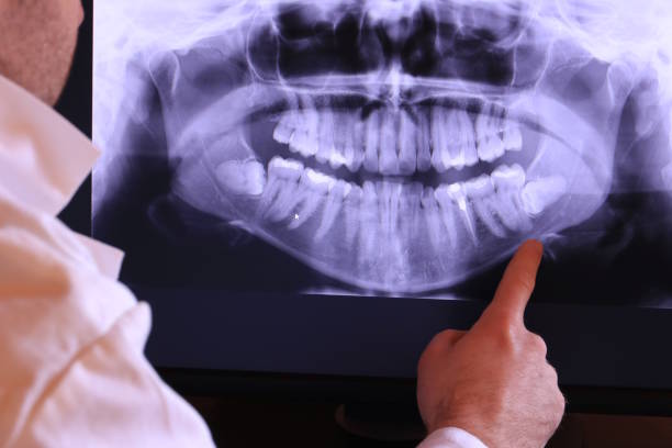 Best Dental Abscess Treatment in Lake Mary, FL