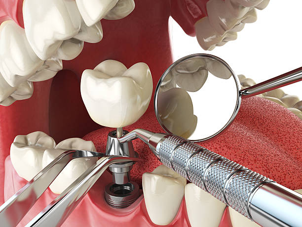 Best Emergency Treatment for Jaw Pain or Injury in Lake Mary, FL