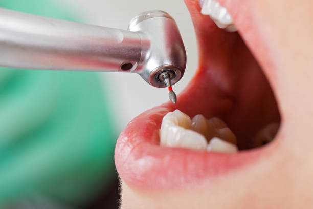 Best Emergency Treatment for Oral Infections in Lake Mary, FL
